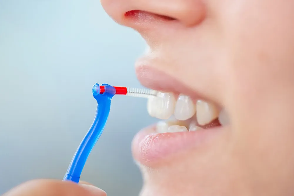 Den riktige måten å bruke en interdentalbørste på